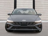 2026 Hyundai Elantra HEV Luxury w/Two-Tone Interior image 2
