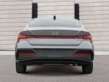 2026 Hyundai Elantra Preferred image 4