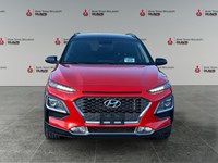 2018 Hyundai Kona 1.6T Trend AWD